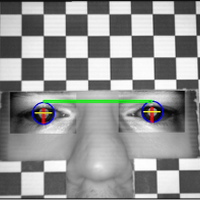 Automatic Measurement of Eye Features Using Image Processing