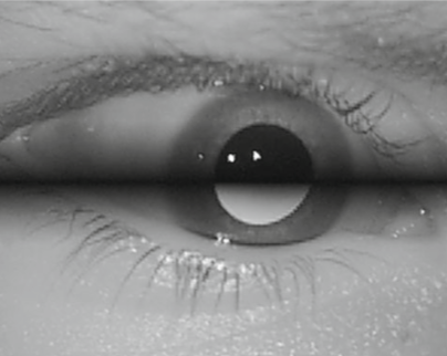 xSDL: stroboscopic differential lighting eye tracker with extended temporal support